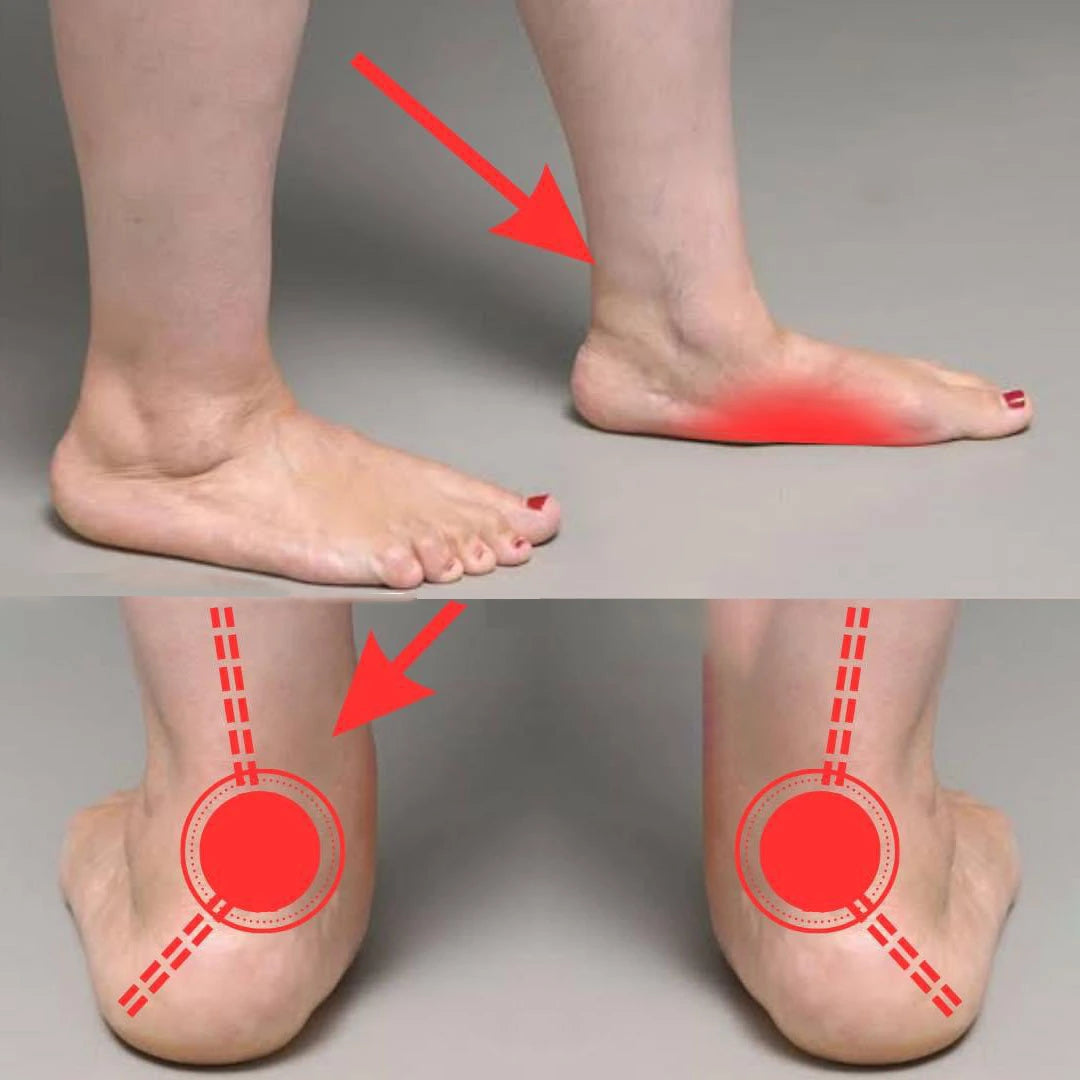 دعامات طبية للقدم